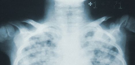 Radiografía digital de la salud del paciente mexicano